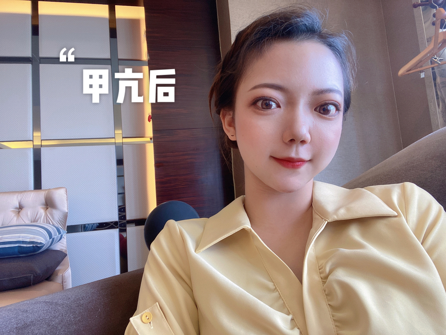 甲亢前后容貌变化…|容貌焦虑·眼凸 甲亢是2020年10月确诊,到现在6