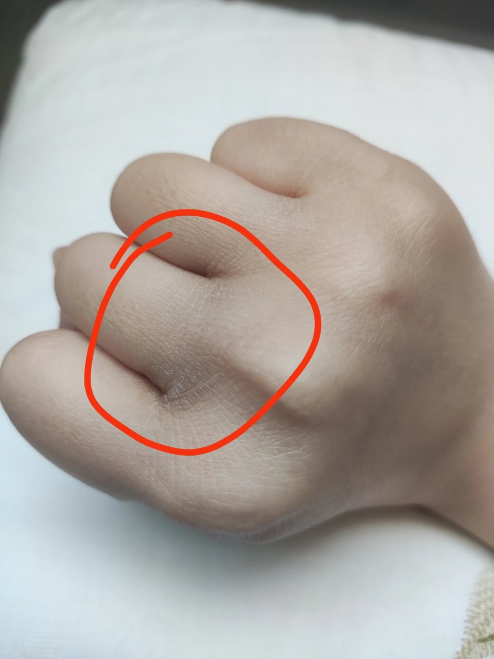 手指缝变黑到底是怎么回事啊?