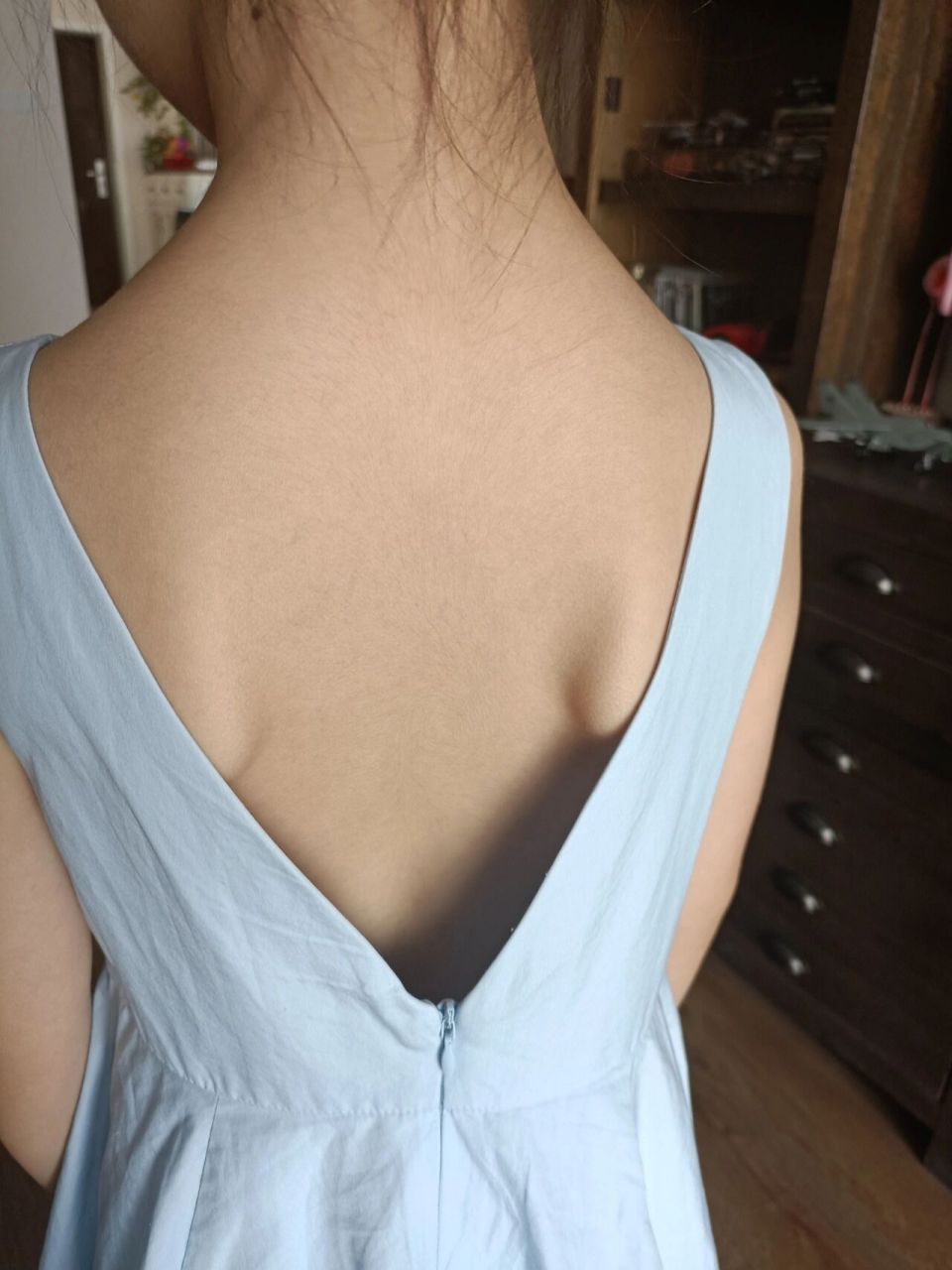 "蝴蝶骨"7岁女童 妹妹5岁的时候,无意中发现她的后背骨头凸起,在网上