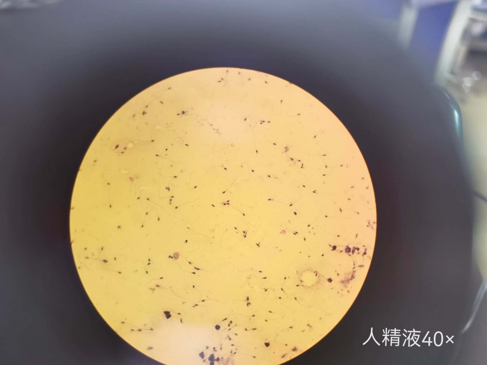生精小管结构 生精小管结构 生精细胞(germ cells),包括精原细胞,初级