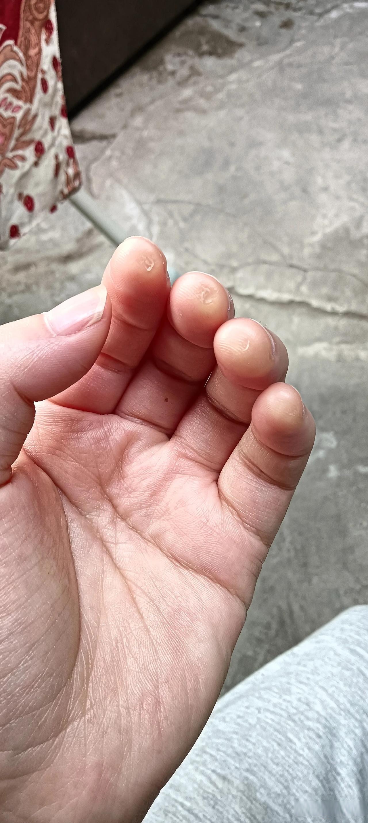 这是10多天没弹吉他的手