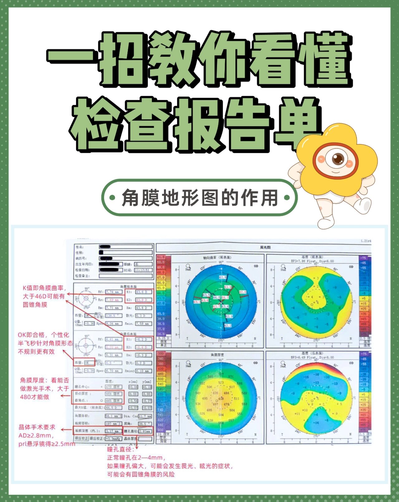 角膜地形图的作用图片