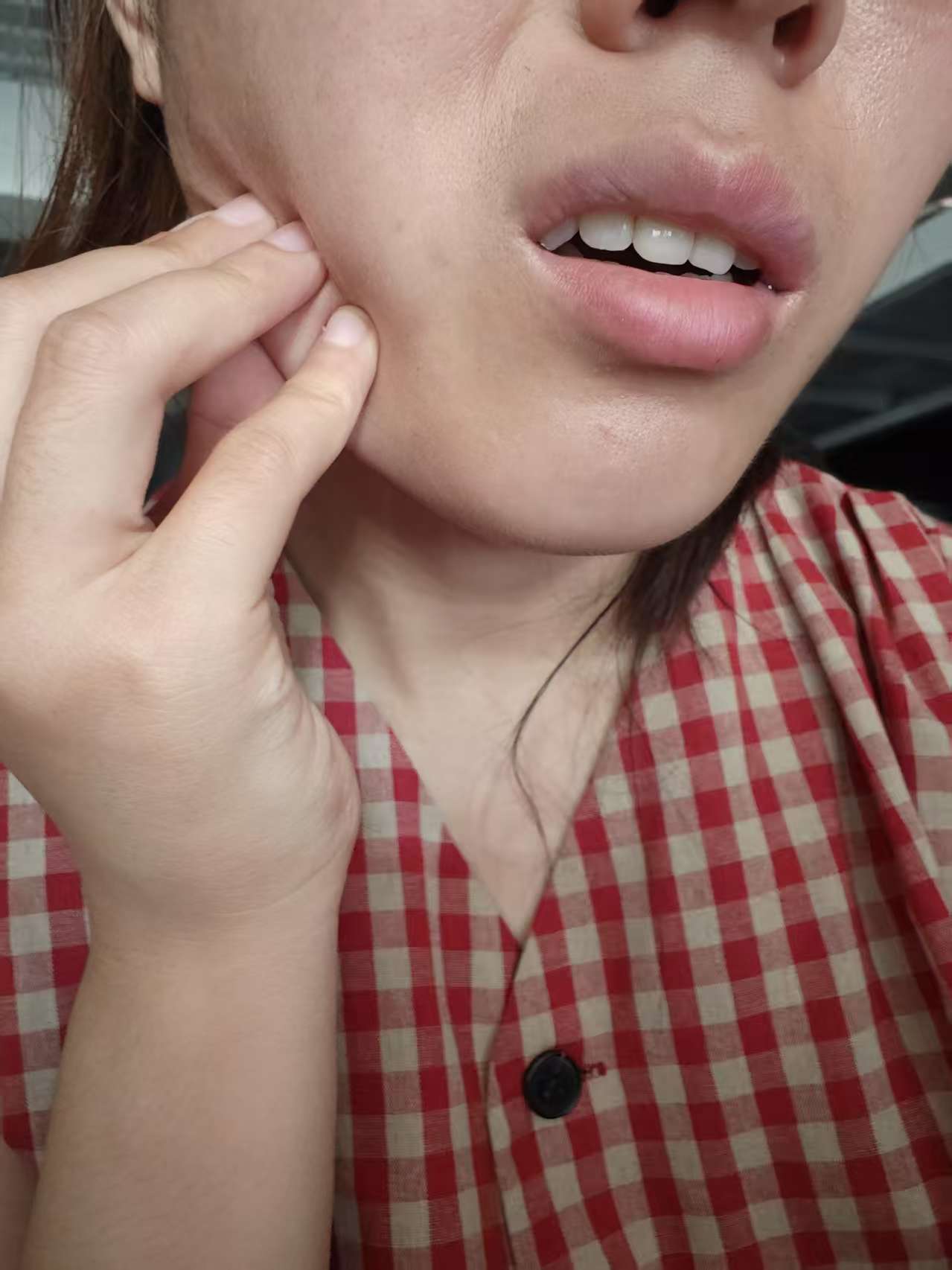 腮部按压疼痛但不按不痛,常见原因包括外伤,腮腺炎,淋巴结炎,牙周炎