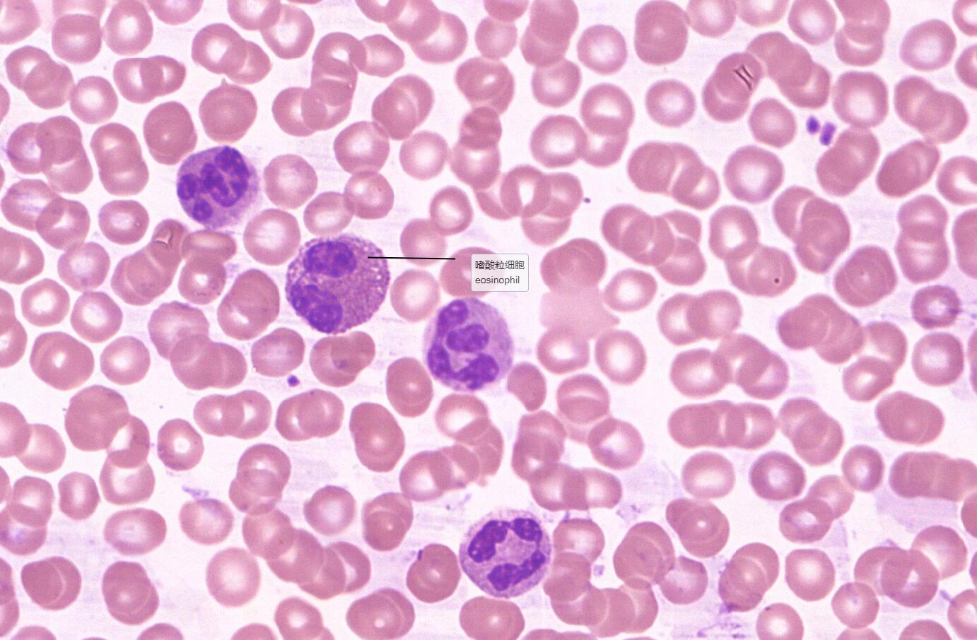 5 血液:白细胞5分类 名称:血涂片 染色:瑞氏染色(10×) 来源:人 描述