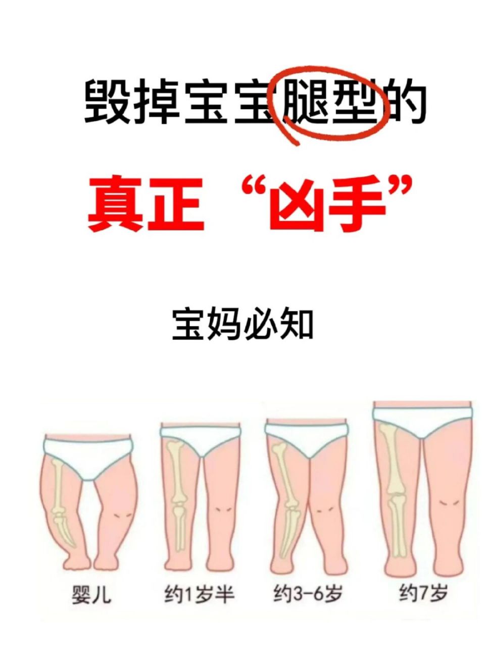 98宝宝罗圈腿,和这五个习惯有关7515自测7215 新生儿期宝宝