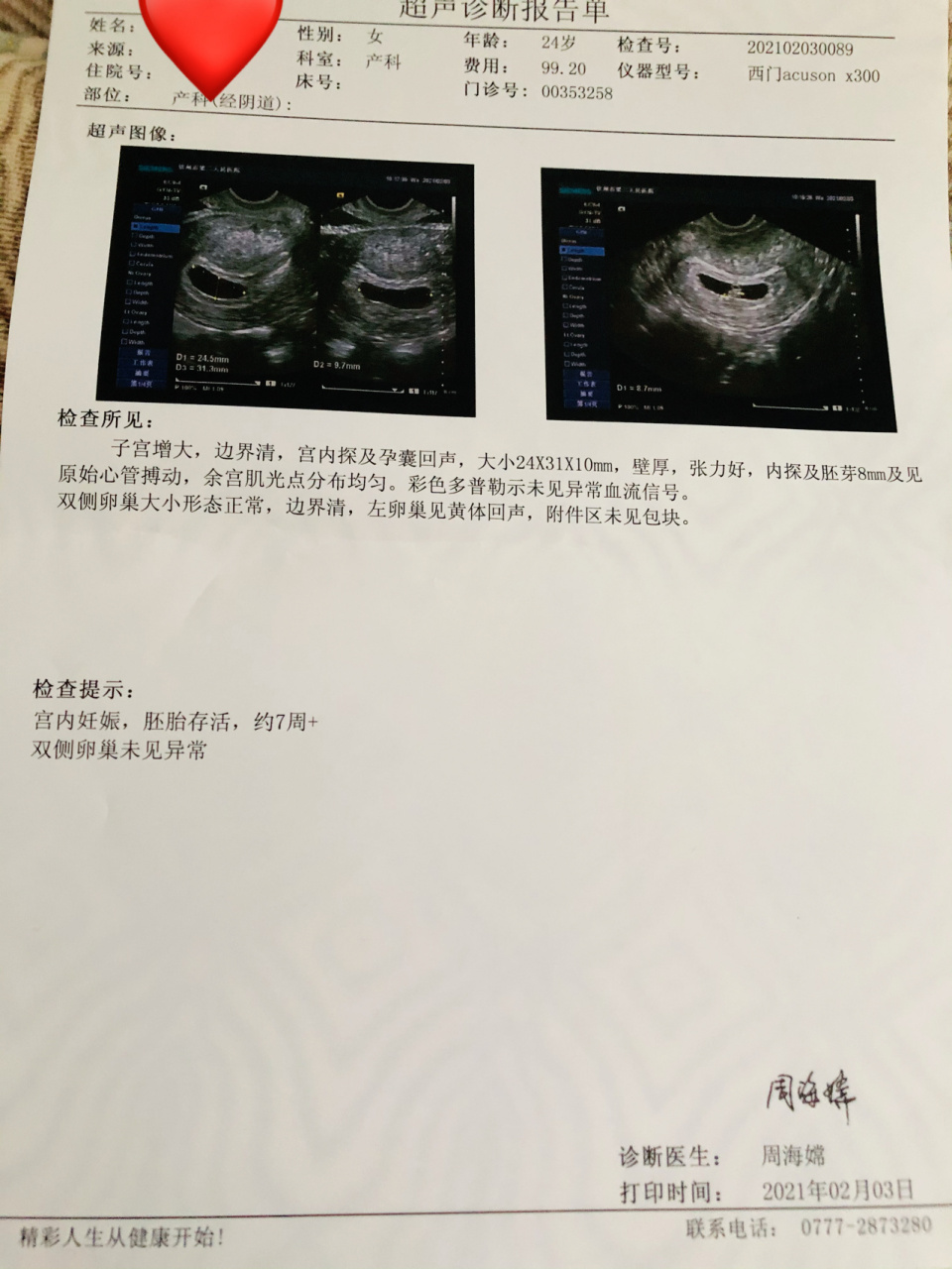 b超单看男宝女宝 听说的宝宝会通过b超单看男宝宝女宝宝 不管是男孩