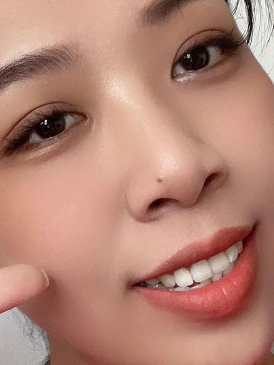 鼻子上的痣到底好不好,需要去掉吗 有说漏财的,也有说没有影响