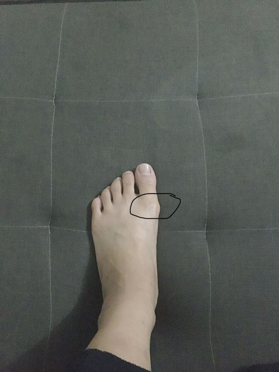 脚趾头痛01