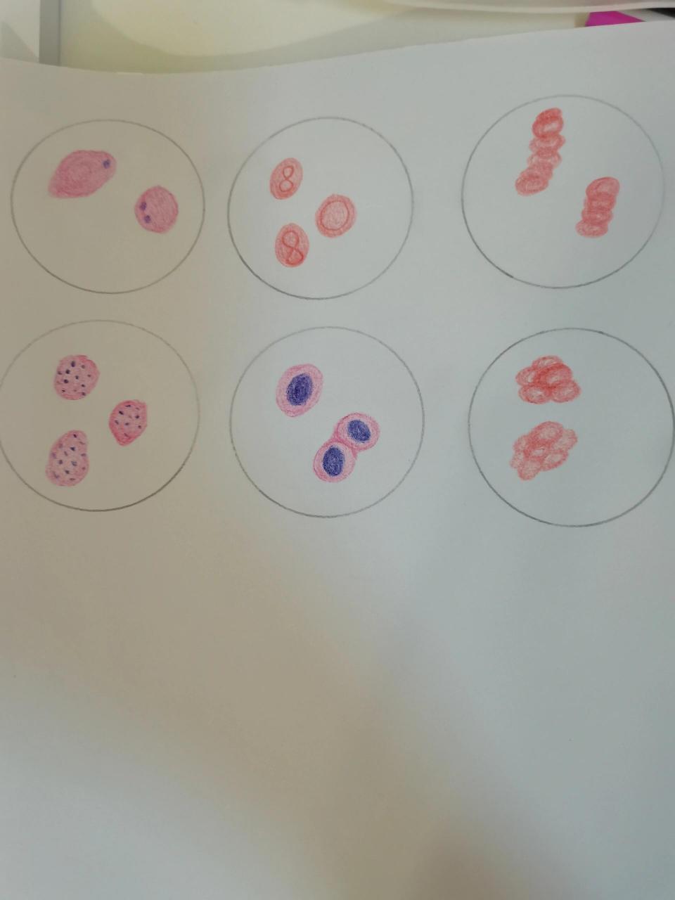 红细胞异常形态绘图 镜下绘图实验报告