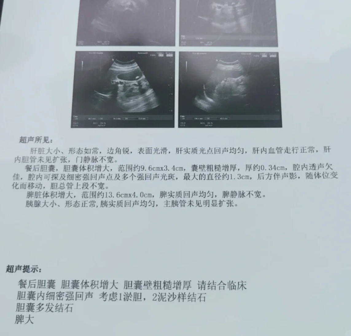 最常见的原因包括胆囊炎,胆结石和胆管肿瘤