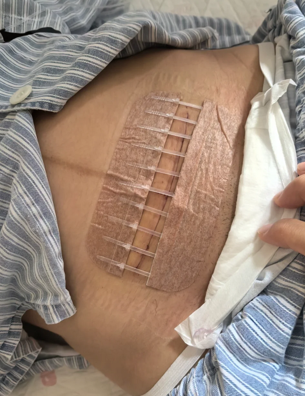 孕37周羊水偏少不一定必须生,要看具体情况