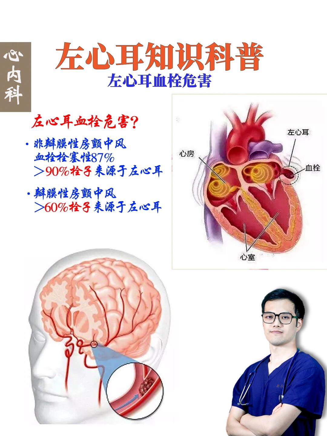 左心耳血栓图片