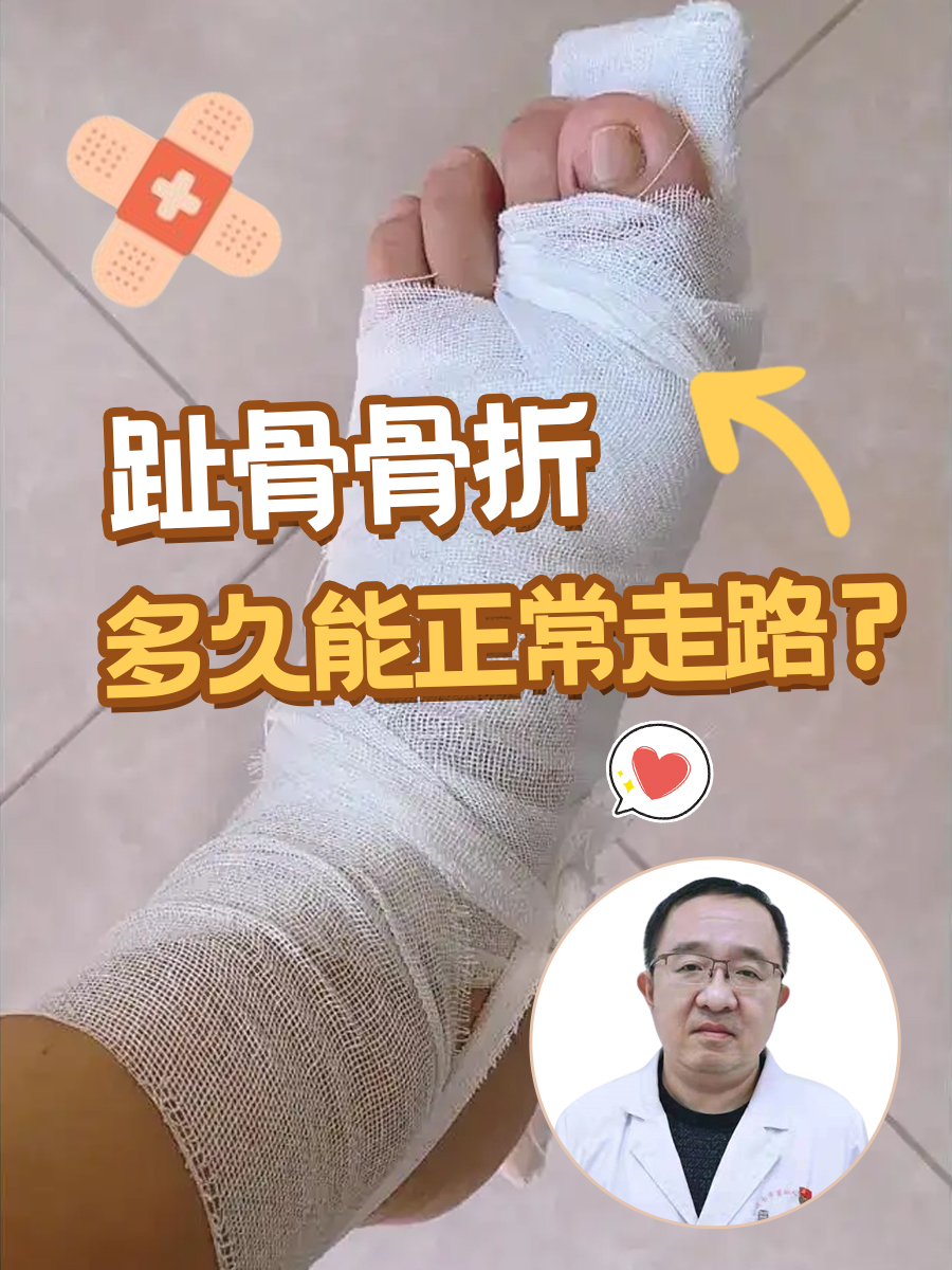 趾骨骨折,多久能正常走路?
