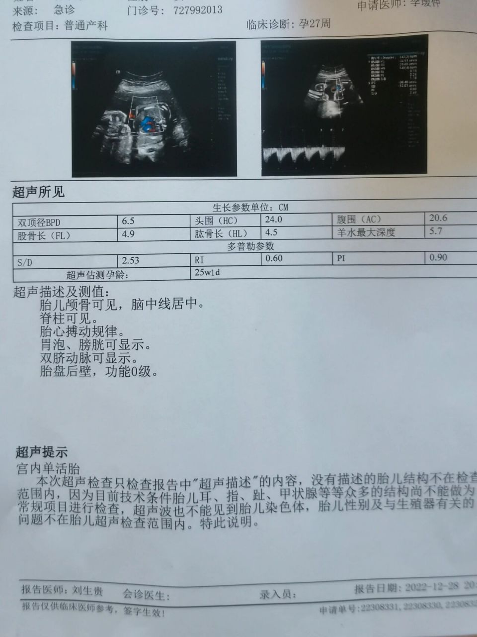 怀孕27周,加上感染新冠,宝宝偏小2周