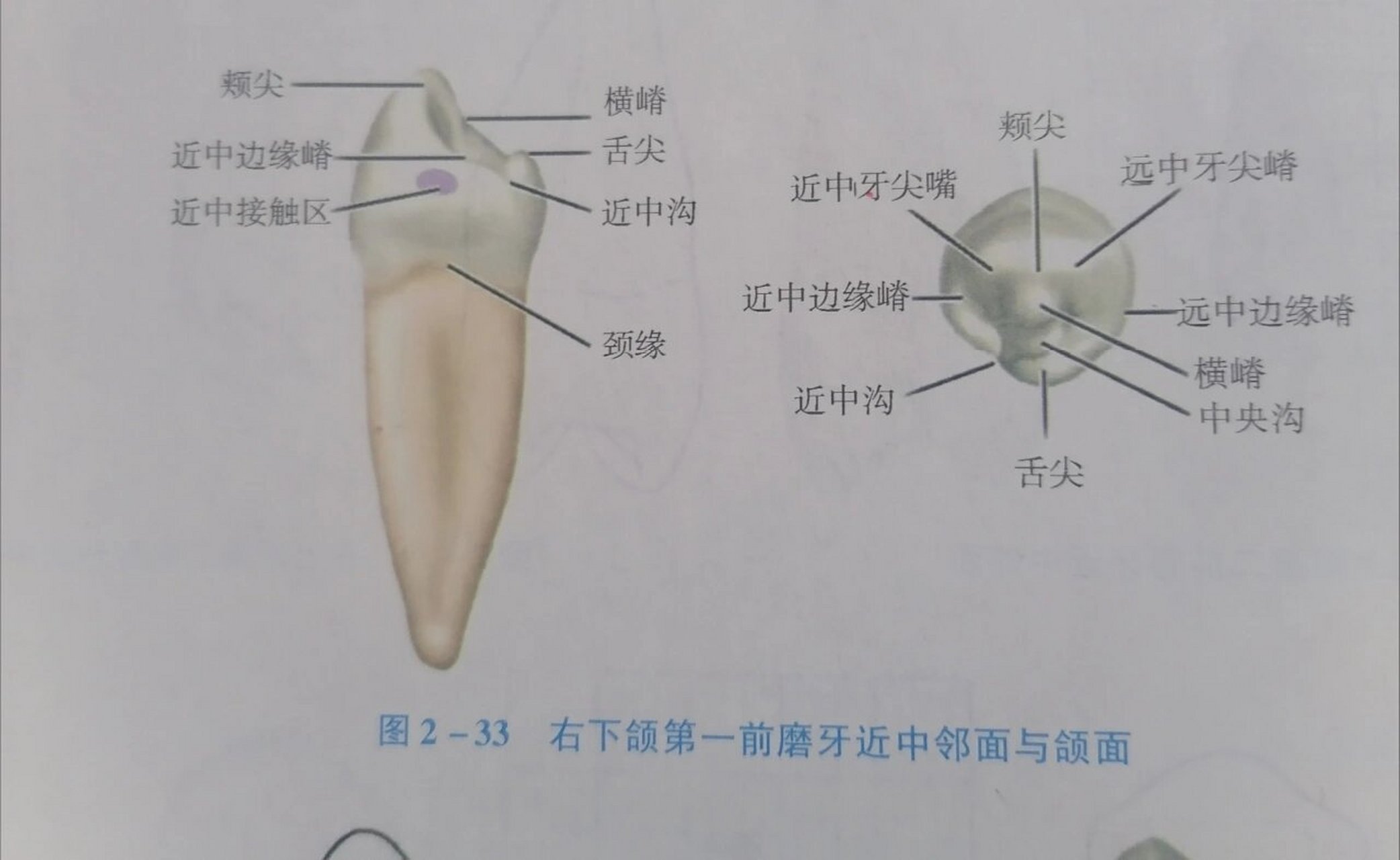 牙颊沟图片