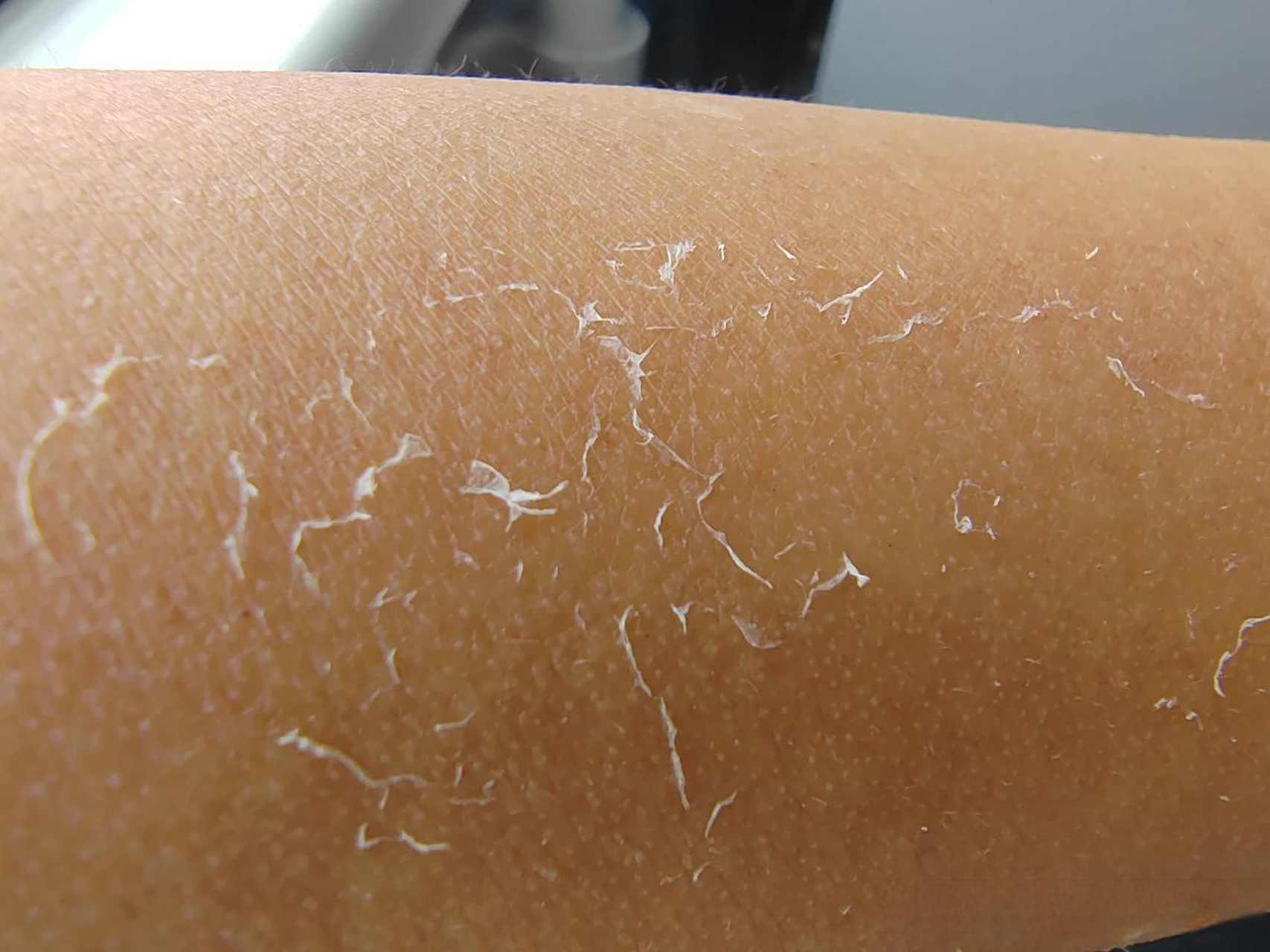 手杆上不是长白毛了,是晒破皮了,这该死的太阳.