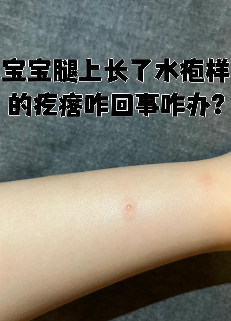 水痘长啥样小孩腿上长小疙瘩是怎么回事身上起红包有水泡是怎么回宝宝