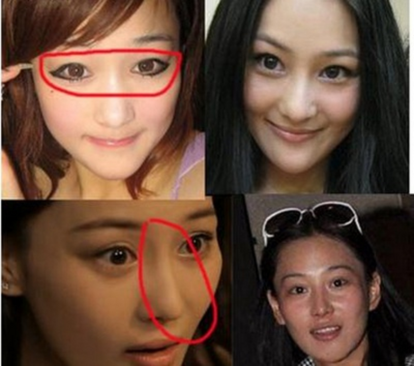 为什么明星整容越来越美!而普通人一整就是网红脸?