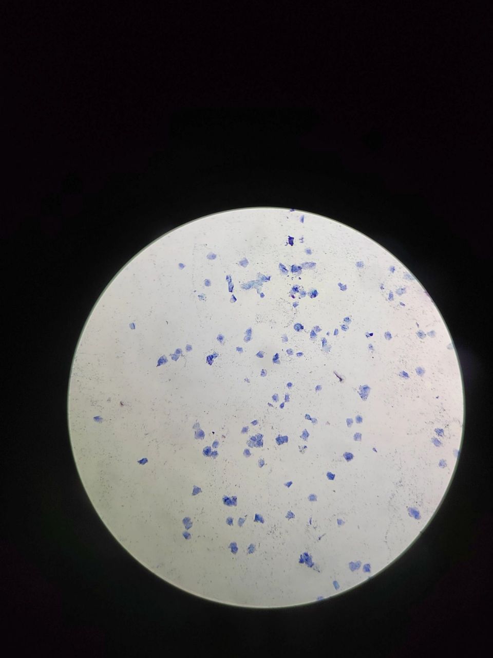 终于找到了我的x染色质 找了好多好多遍,终于找到了我的x染色质