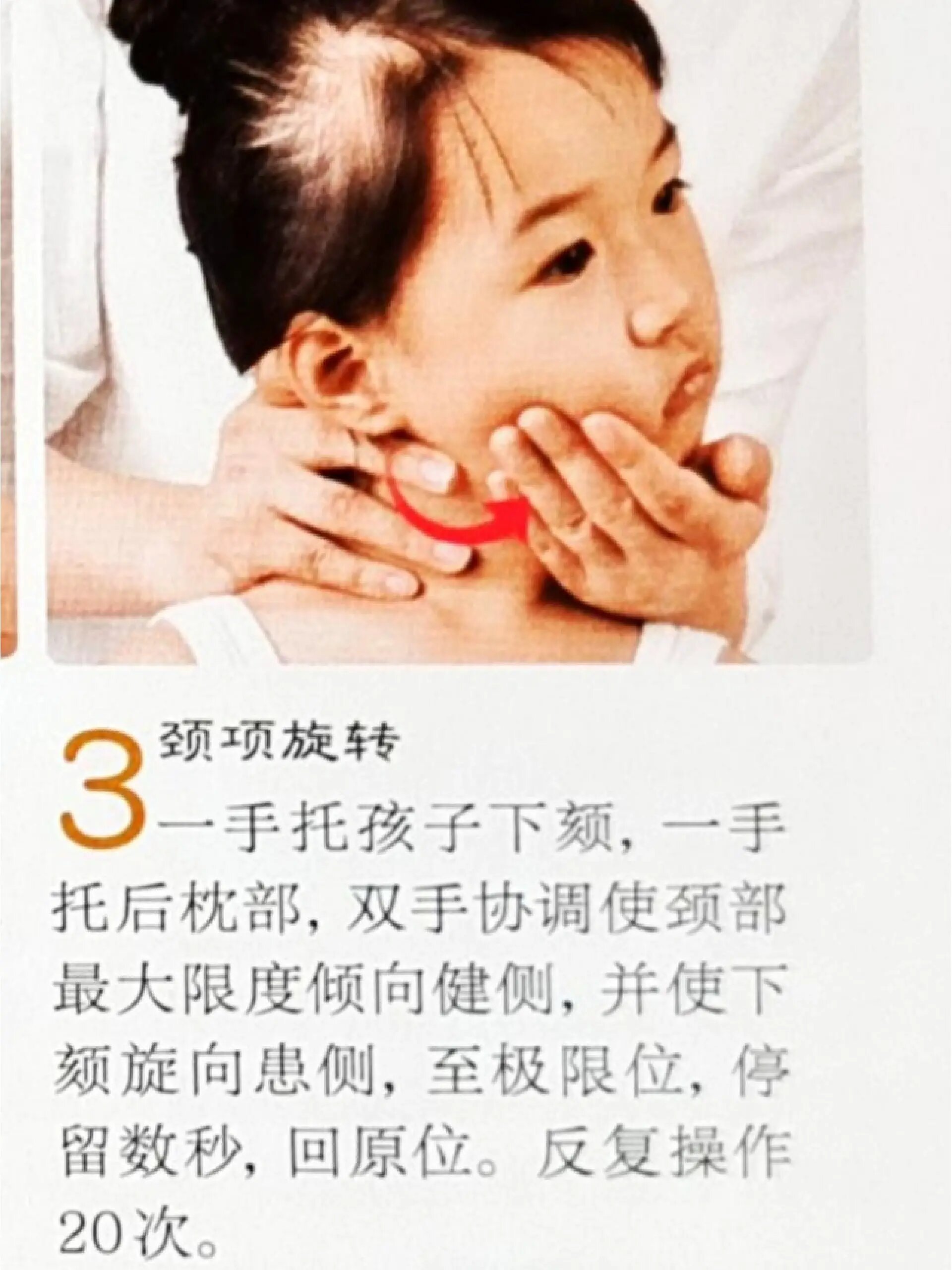小儿推拿—帮忙应对小儿肌性斜颈 应评论区要求分享小儿推拿—应对
