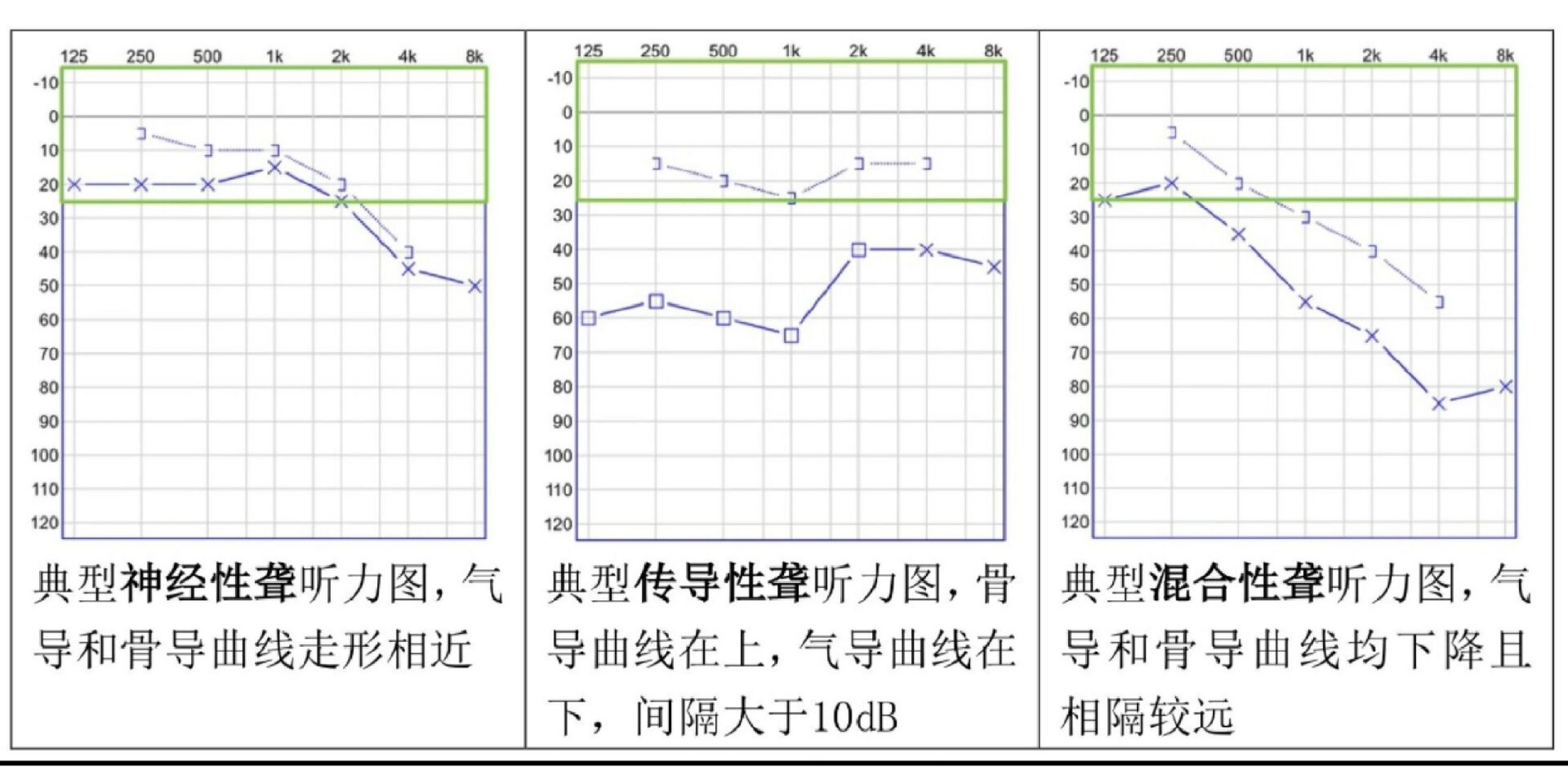 其实看懂听力报告并不难. 	 第一步,看数字.
