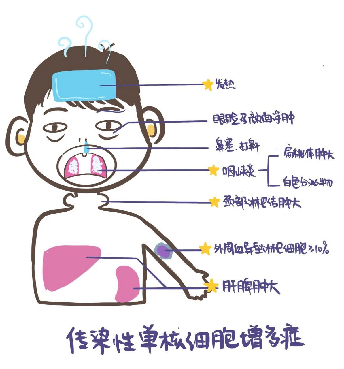 医学生笔记9999697115传染性单核细胞增多症 今天,我发烧了