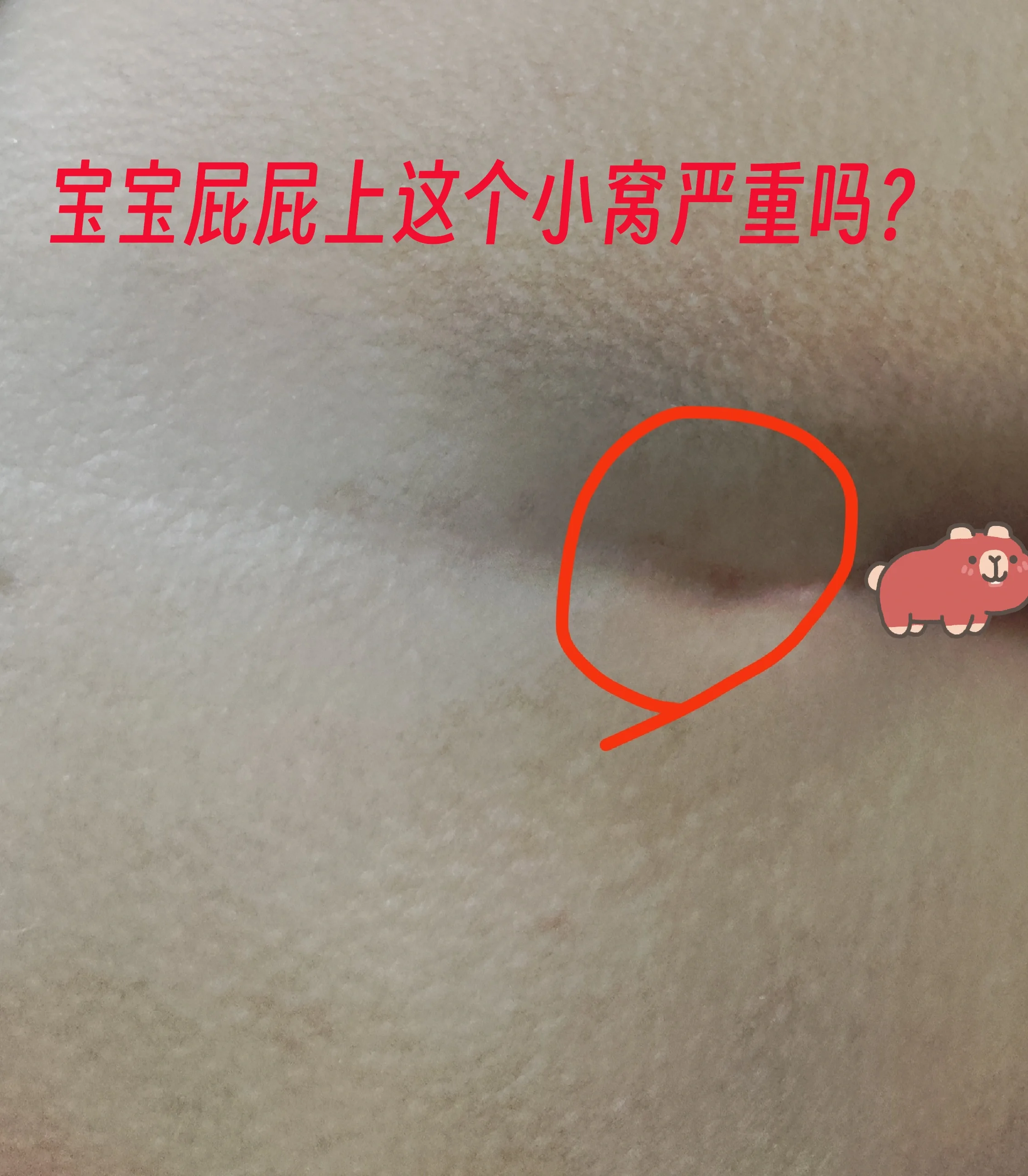 深圳儿童医院2周岁体检以后我又焦虑了