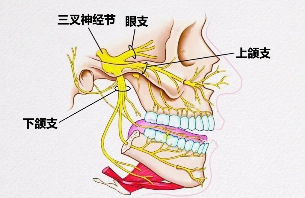 三叉神经痛的症状图片