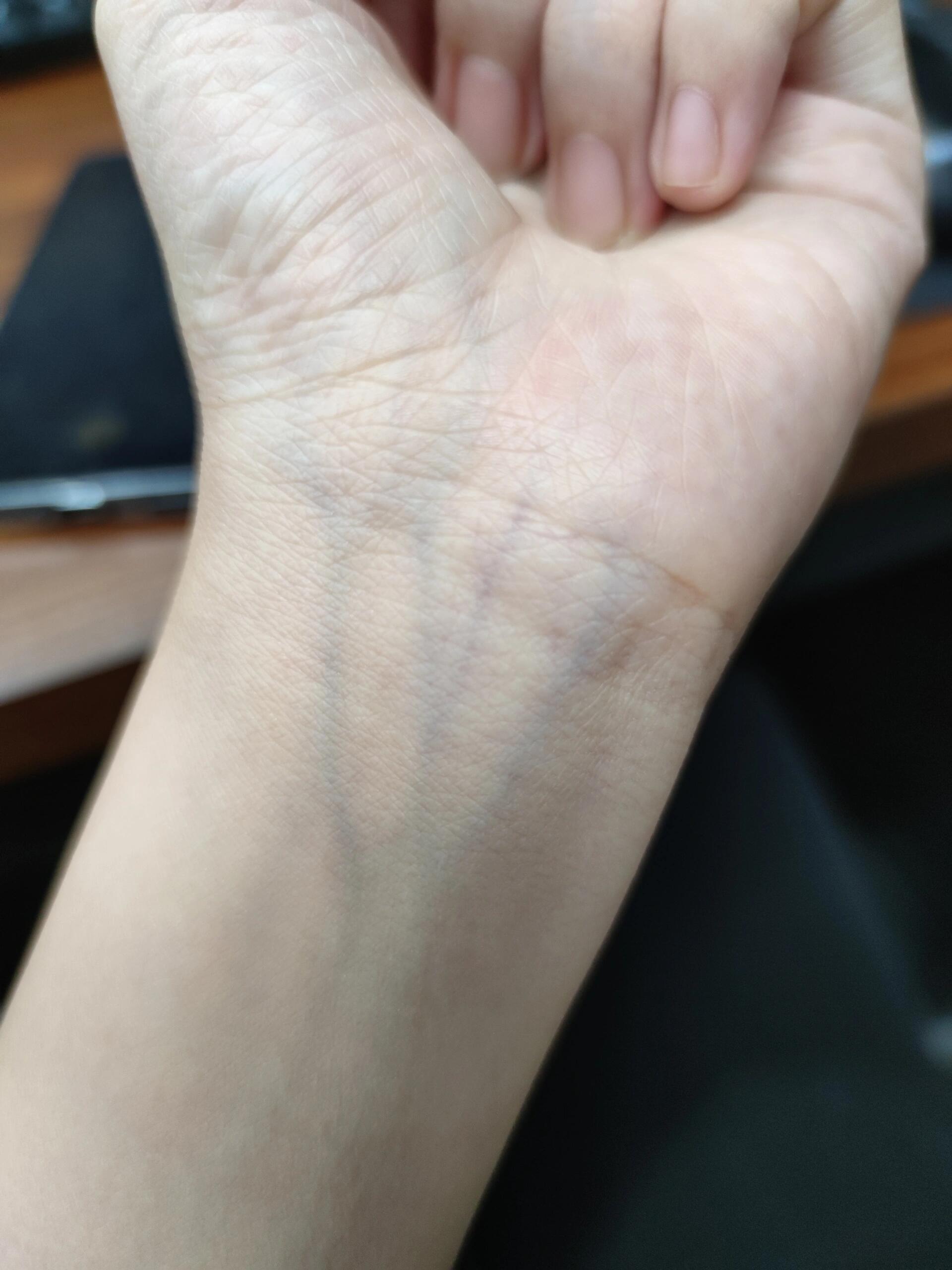 求问医学生,为什么血管有的绿有的紫啊?