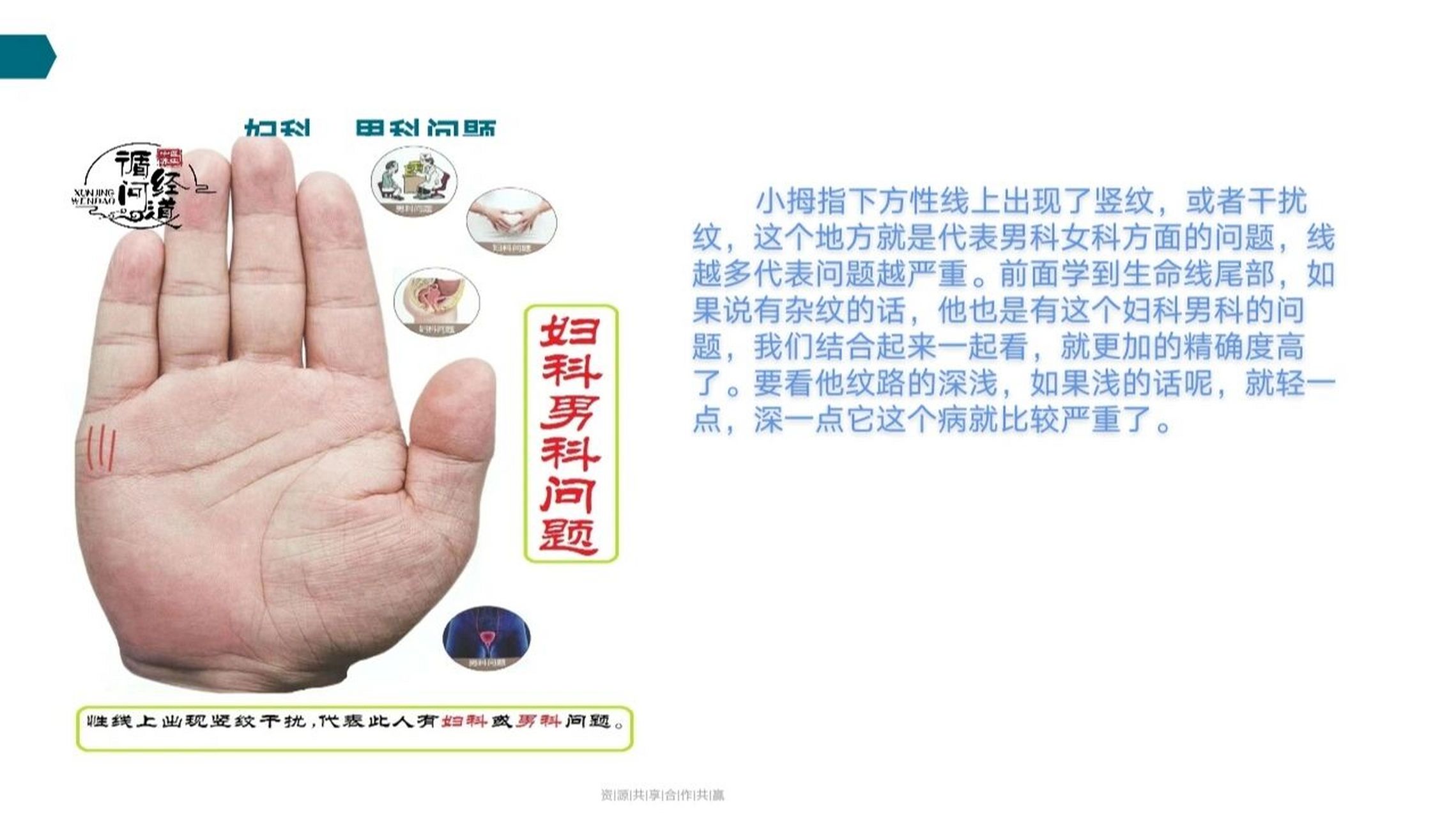 妇科问题 看到这个生命线尾部出现杂纹,或者那种流苏纹,或者说像鱼刺