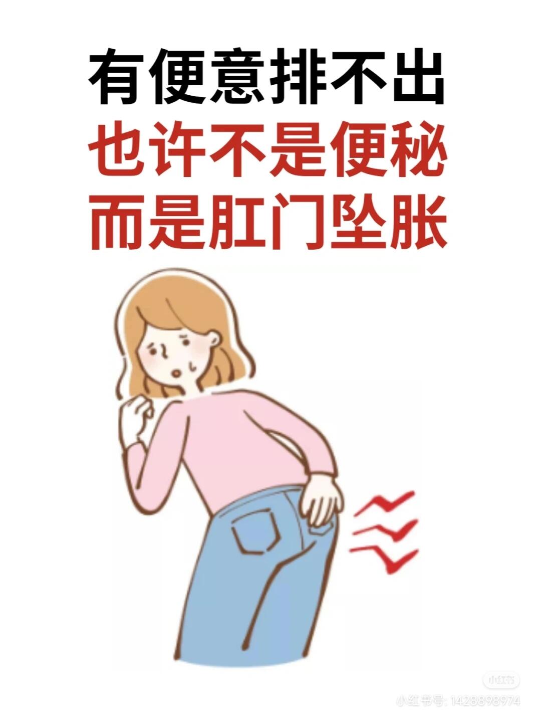 肛门坠胀是一种让人不爽的感觉,好像直肠,肛门和会阴部位被堵住了一