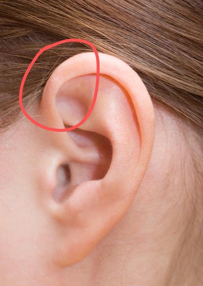 只有碰到或者按压时会痛,而且疼痛范围也不是很大,局限于耳朵没有痛到