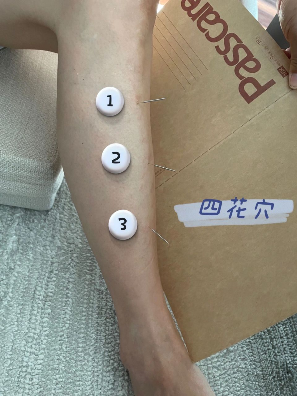 识穴第34篇|【四花穴】消化不良,哮喘,胃 【董氏针灸·四花穴】 消化