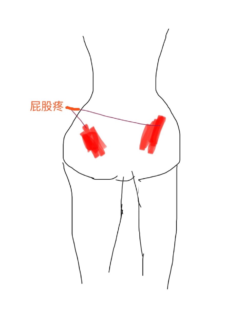 怀孕屁股疼图片