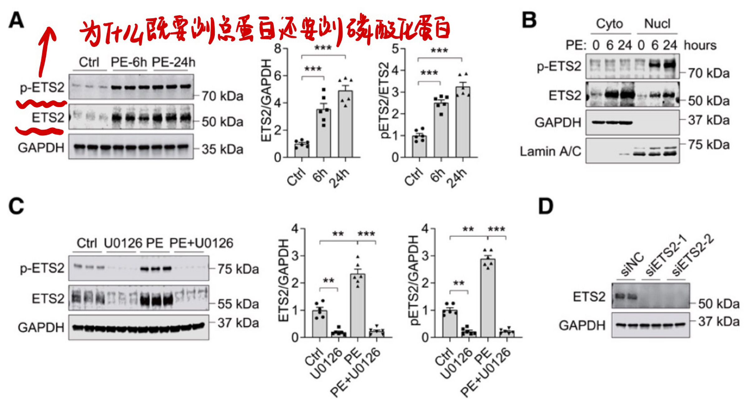 检测磷酸化蛋白为什么要77一个总蛋白做对照 16615因为普遍意义