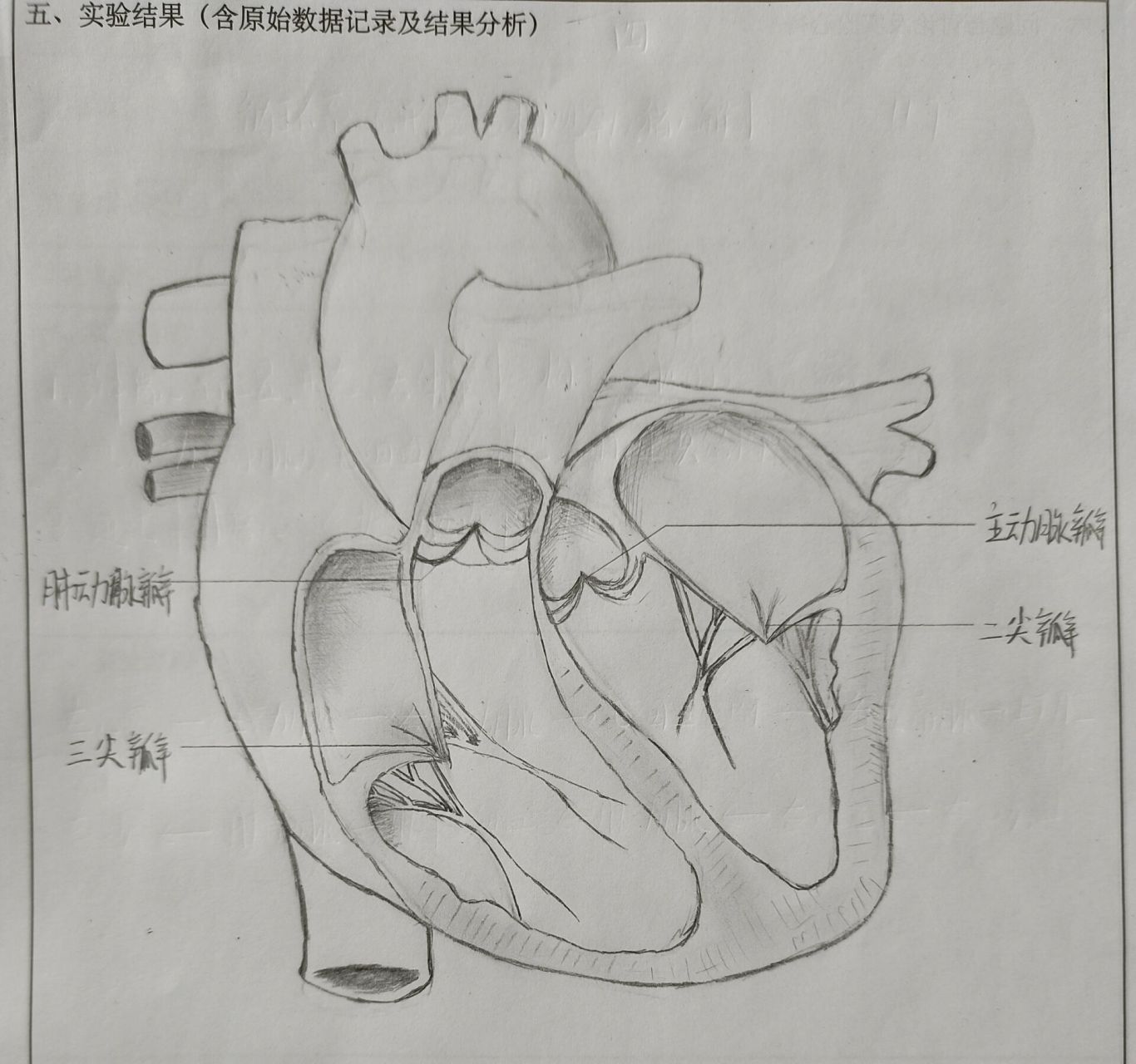 猪心内部解剖图 我是临摹同学的 图三为原图