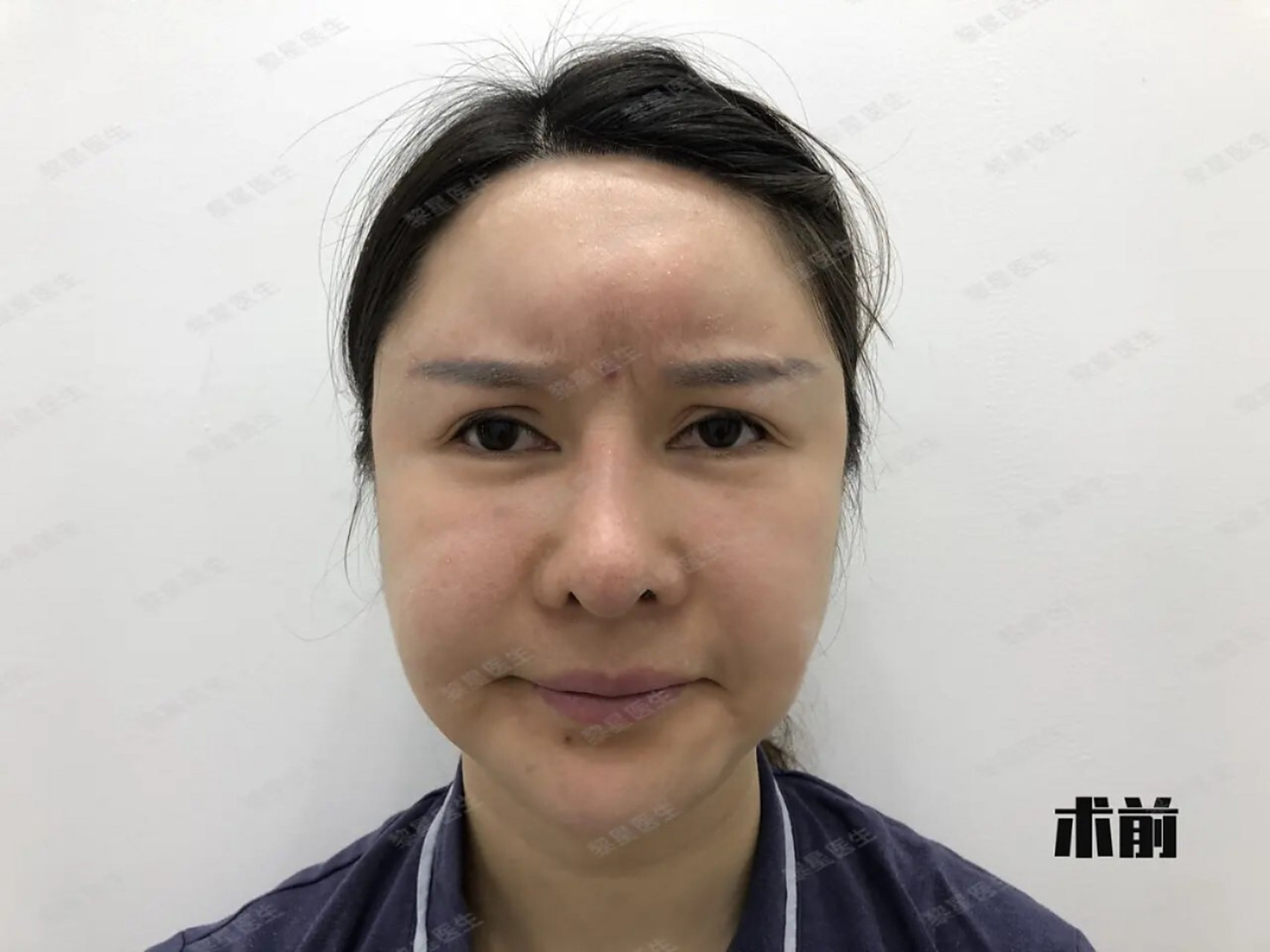 生长因子增生疯长,长得到底是什么?