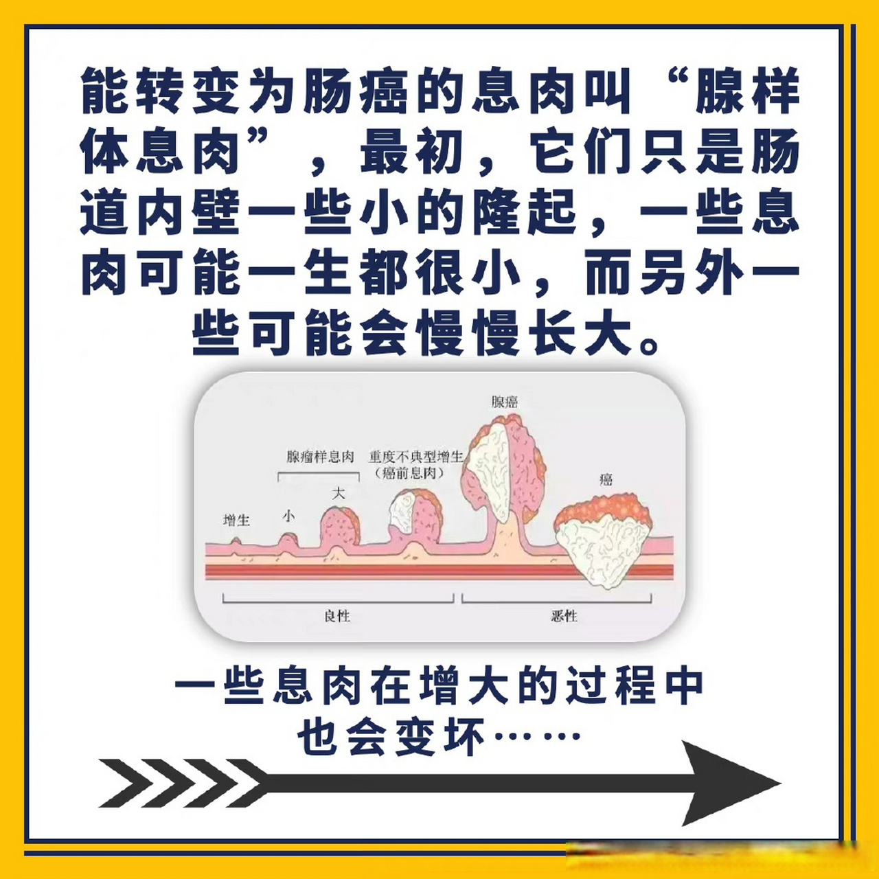 肠息肉是怎么一步一步转变为结直肠癌的呢?