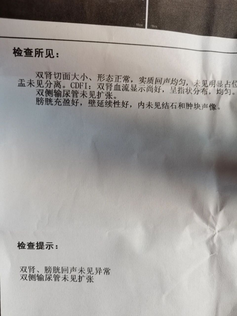 尿隐血 -,会是什么问题 昨天去做了尿检和泌尿彩超,看到检测单上的尿