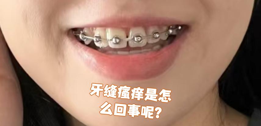 为什么牙会痒