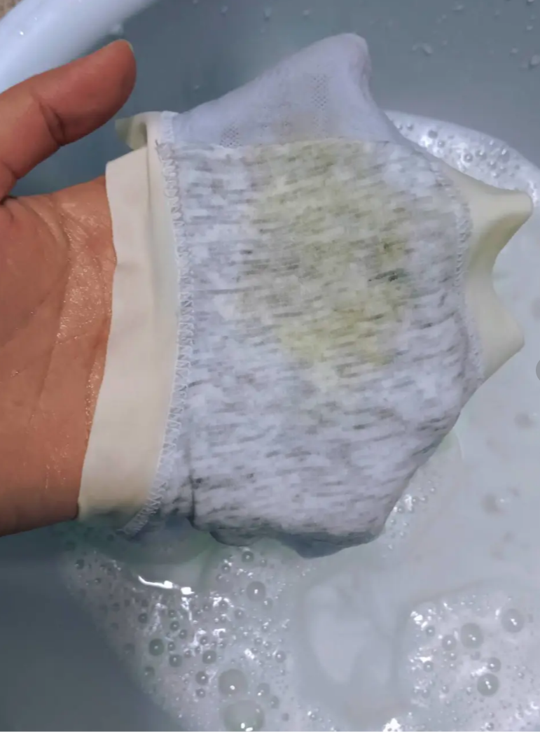 白带像水一样稀薄可能是正常现象,也可能是疾病引起的,需要根据具体