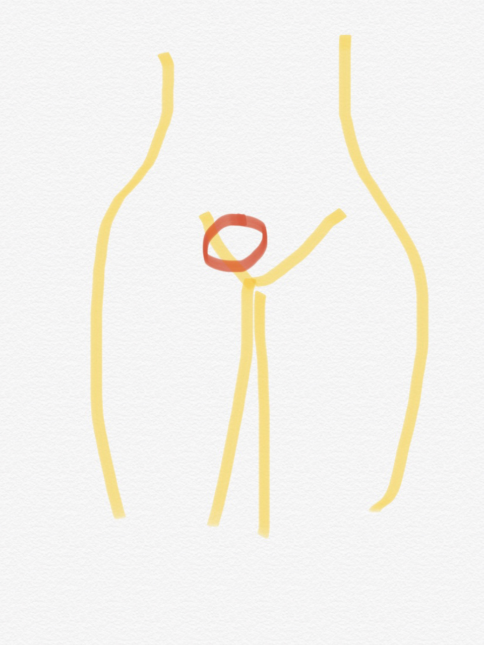 如图,站起,三角区右侧鼓了个很明显的包,按压里面有肿块.躺下.