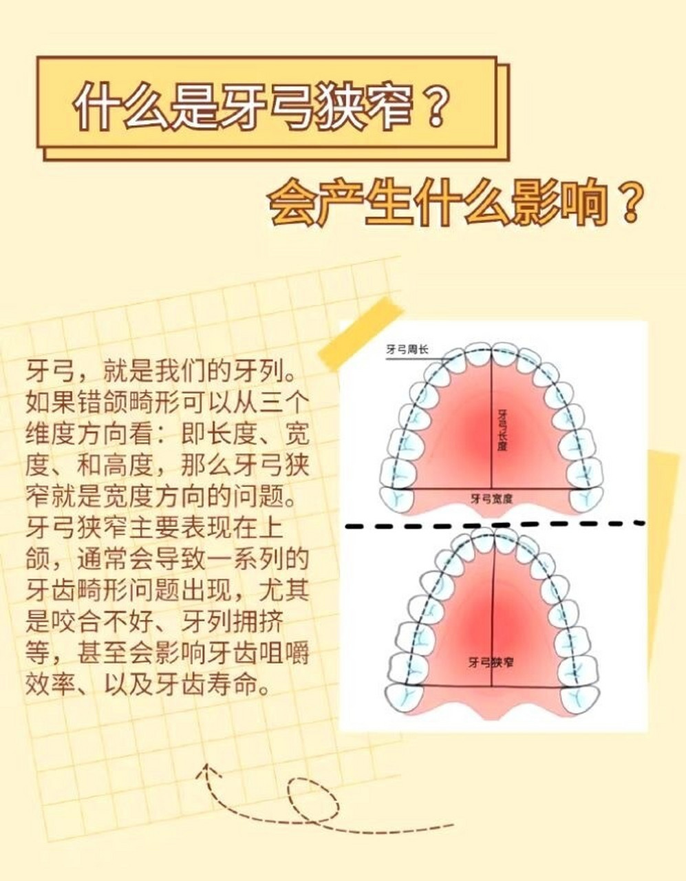 会产生什么影响? 牙弓,就是我们的牙列.