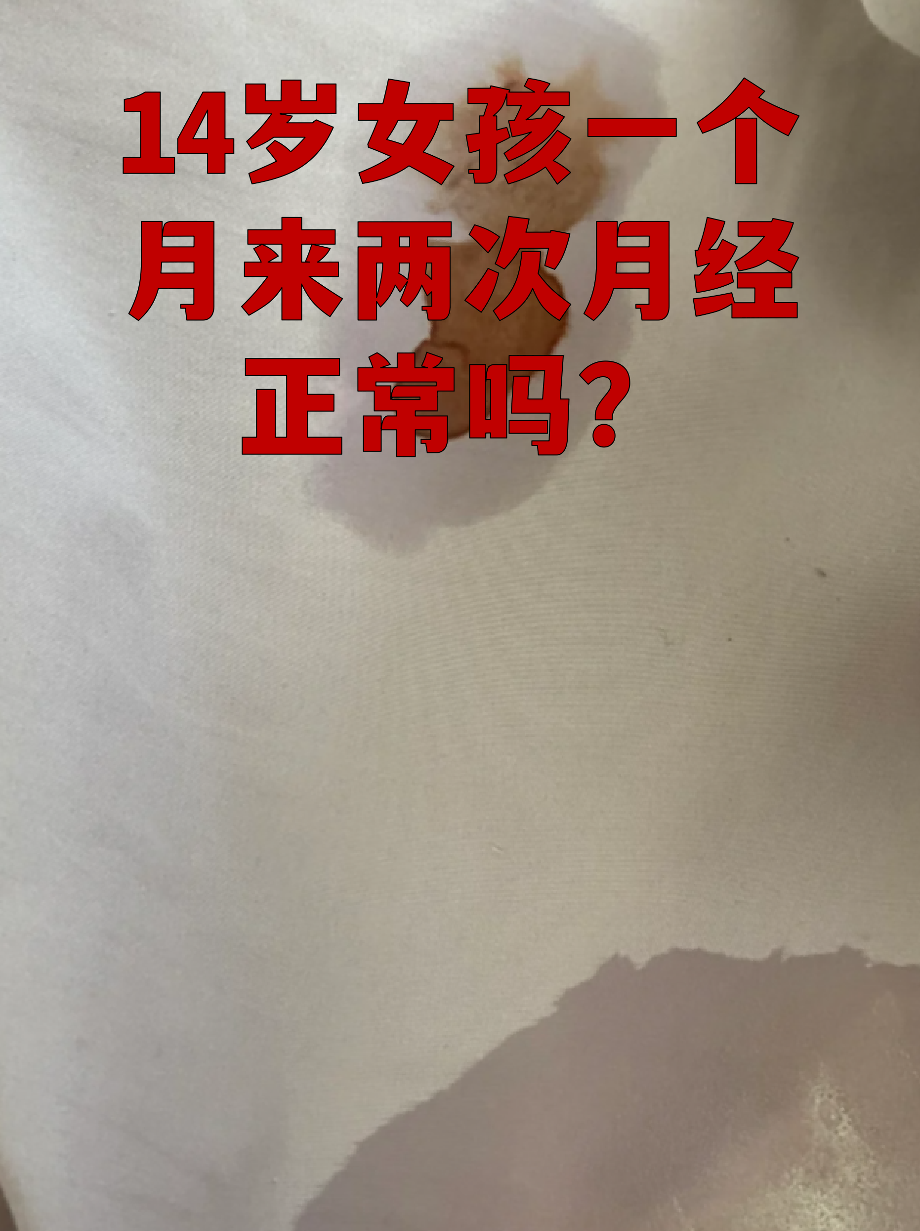 一个月为什么会来两次月经