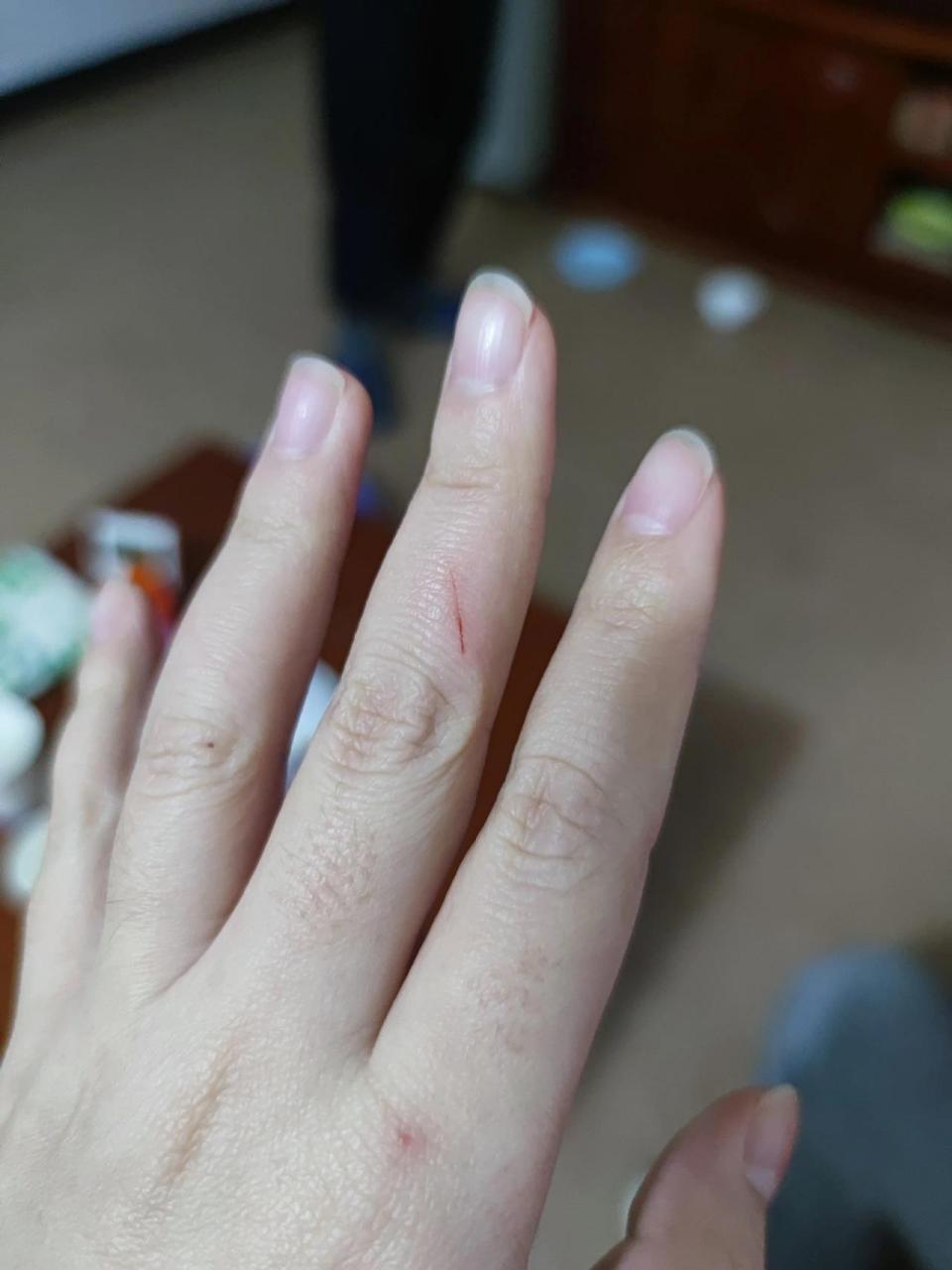 被两个月没打疫苗的小猫咪抓伤,要打疫苗吗 去朋友家和小猫咪玩的时候