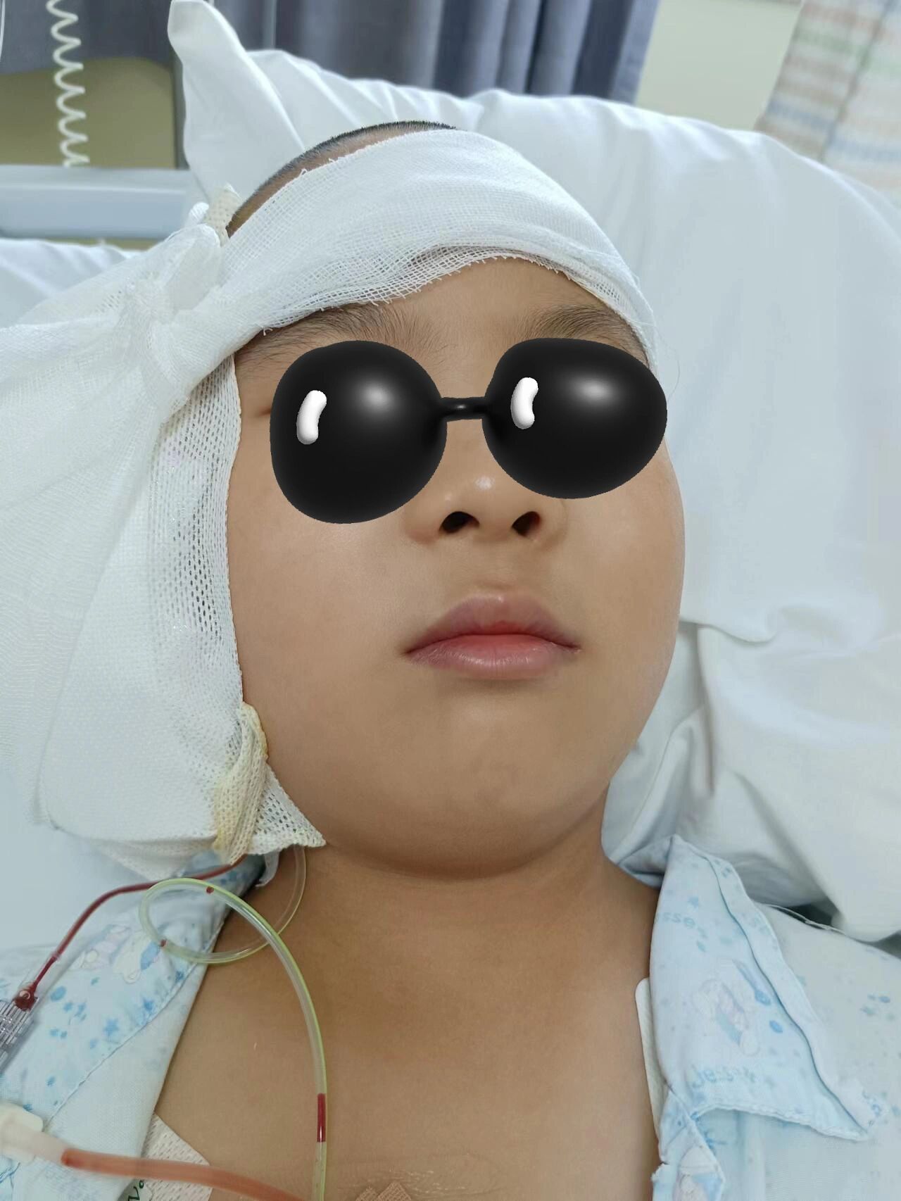 耳再造,五官科张天宇