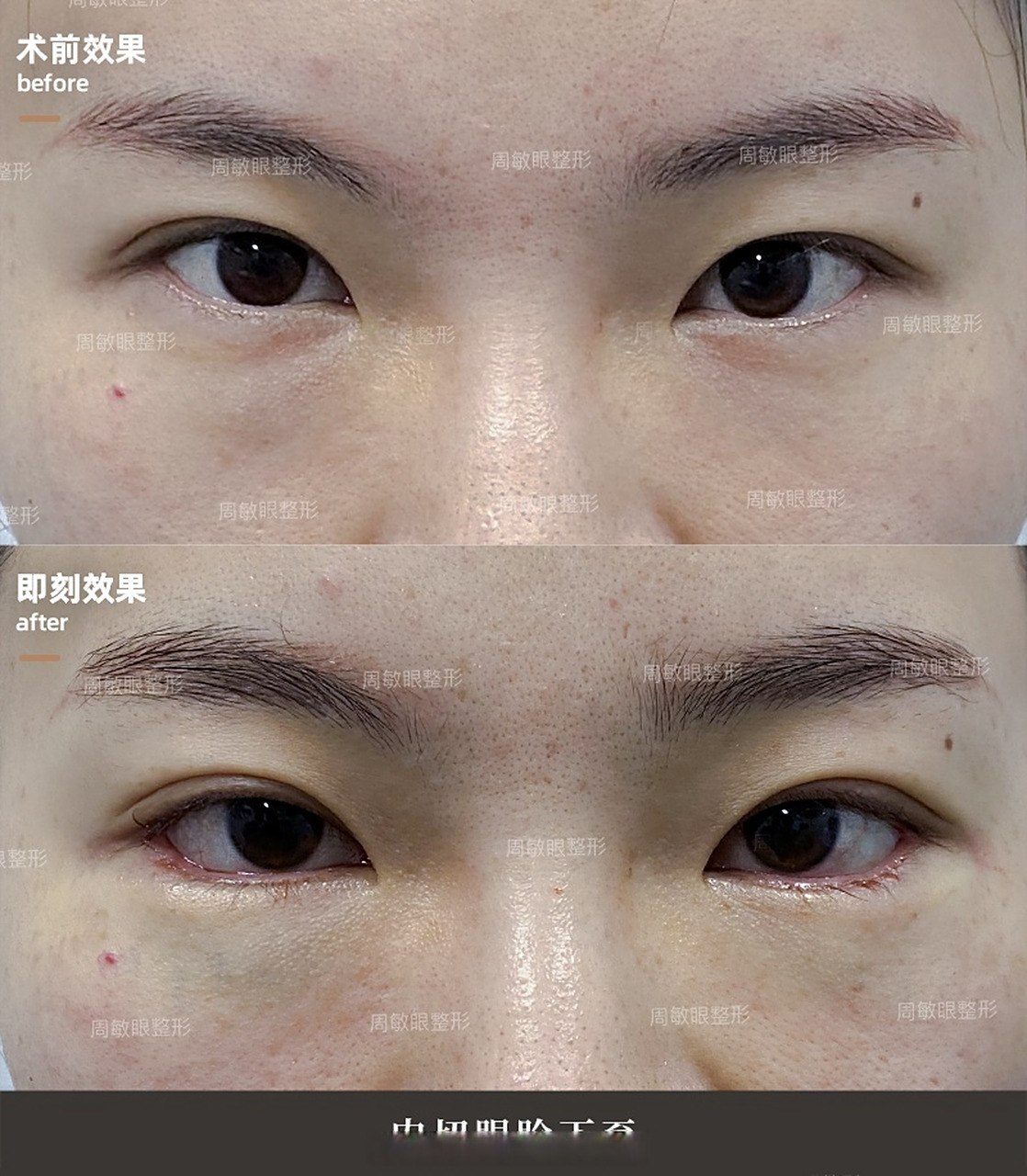 "吊眼"即眼睛向上斜,外眦高于内眦,眼睛呈"倒八"型,这种形态有人喜欢