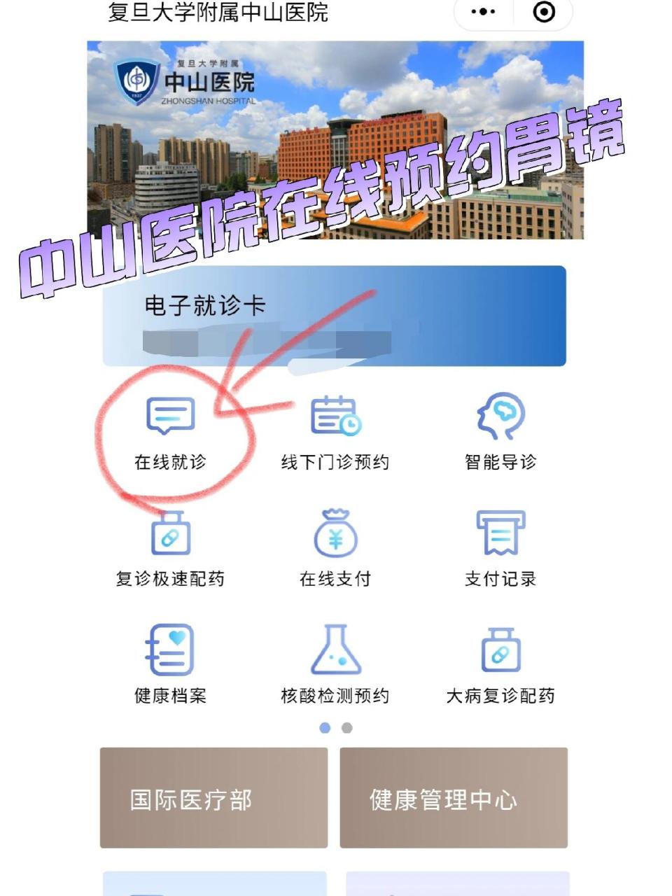 胃镜预约完还用挂号吗(胃镜预约完时间还用挂号吗)