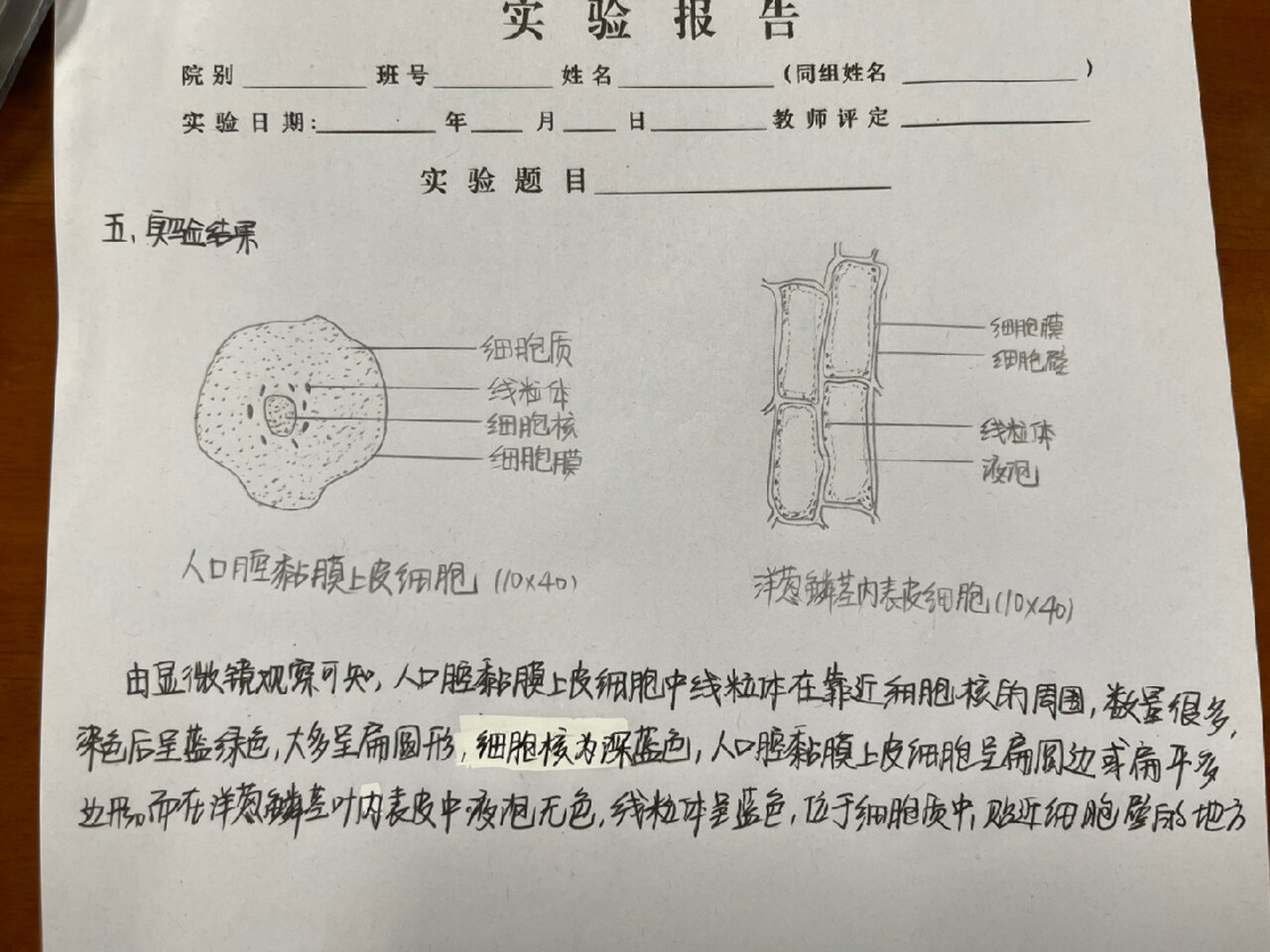 实验报告洋葱手绘图图片