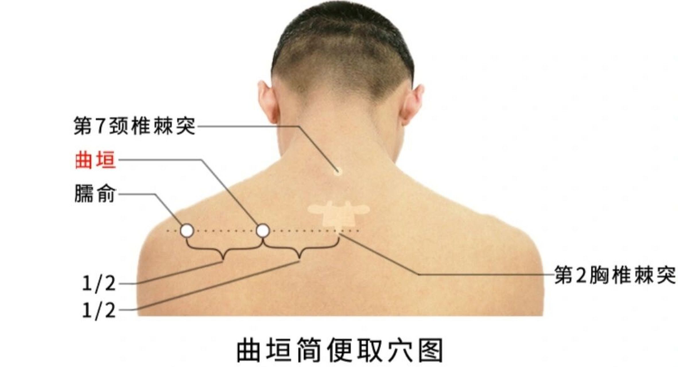 曲垣穴 散风止痛,活络止咳 精准取穴 在肩胛区,肩胛冈内侧端上缘凹陷